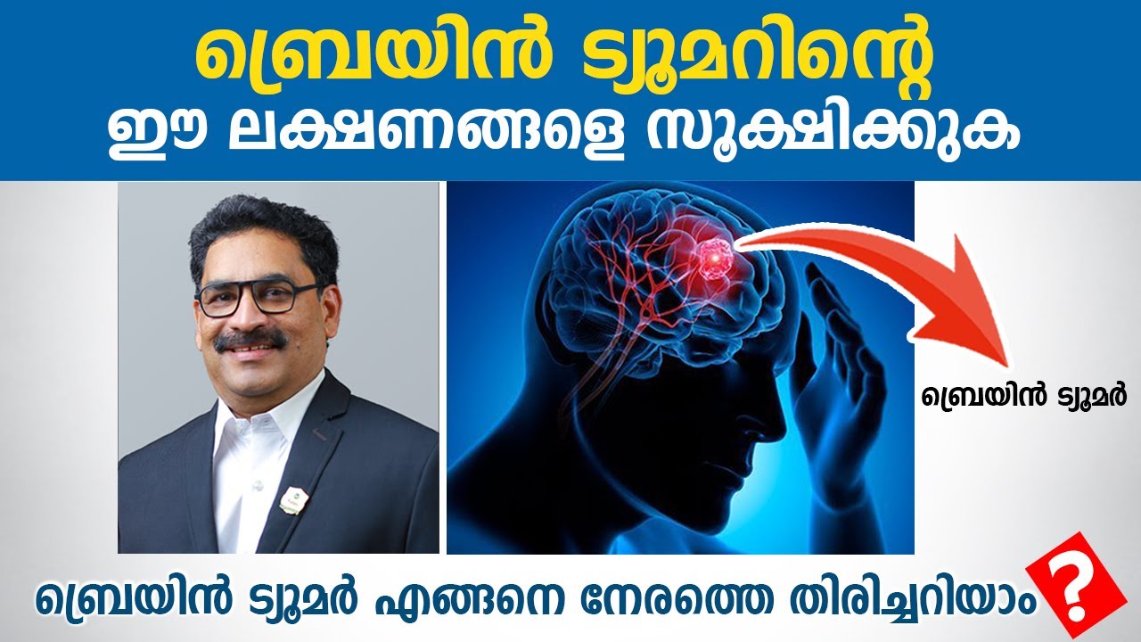 ബ്രെയിൻ ട്യൂമറിന്റെ ഈ ലക്ഷണങ്ങളെ അവഗണിക്കരുത് | Brain Tumor Symptoms | Dr. Shaji K R