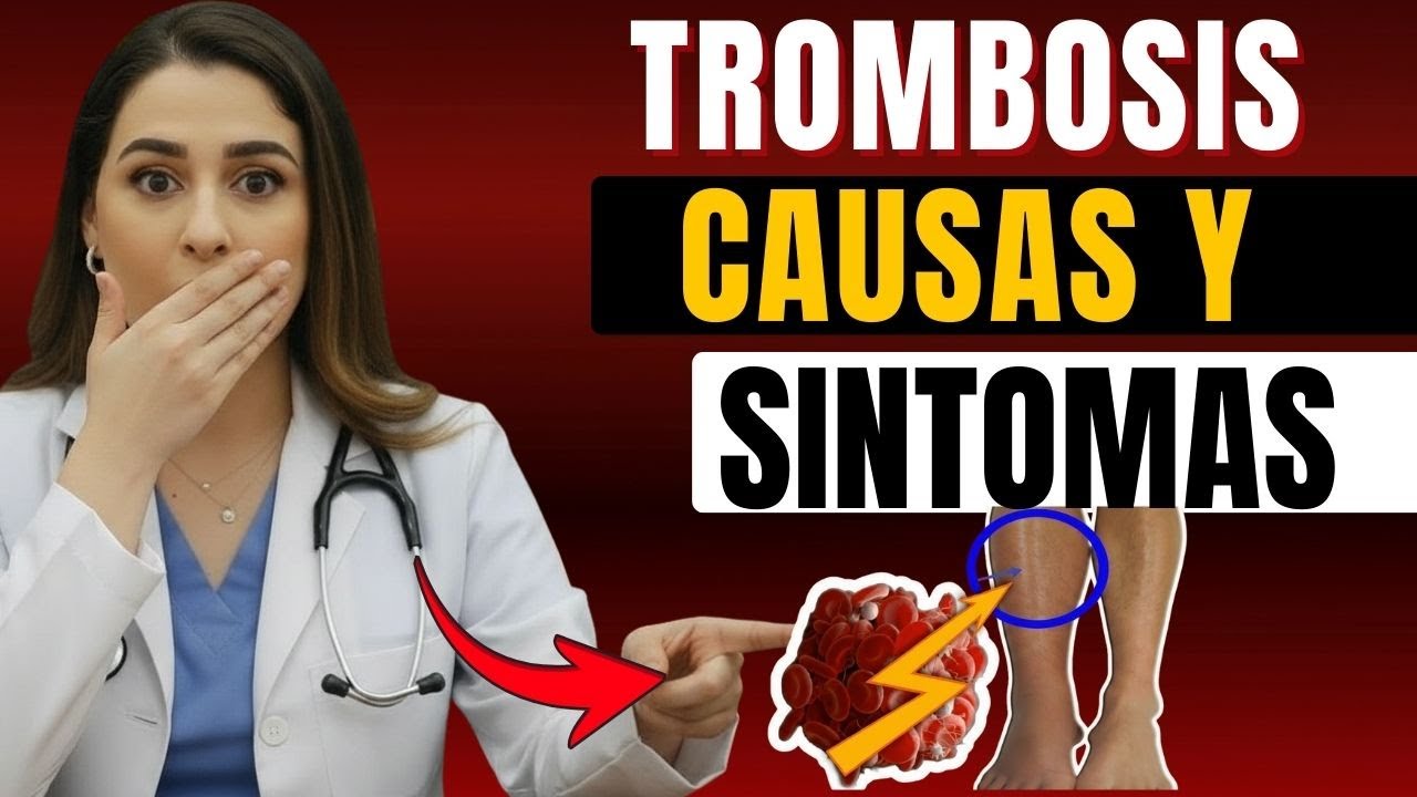 TROMBOSIS VENOSA PROFUNDA en PIERNAS: Causas, Síntomas, Prevención y Tratamiento | Dra. Salome Viana