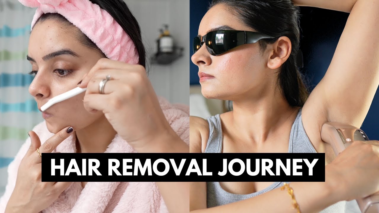 Struggling with PCOS Hair Growth? Here's What Helped Me | IPL for PCOS? ft. SALLOOT