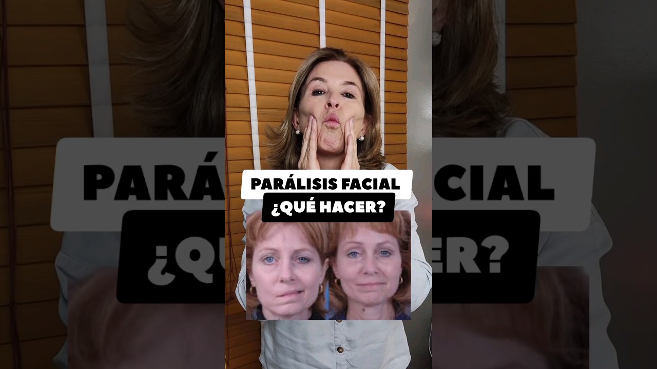 PARALISIS FACIAL &iquest;QU&Eacute; HACER?