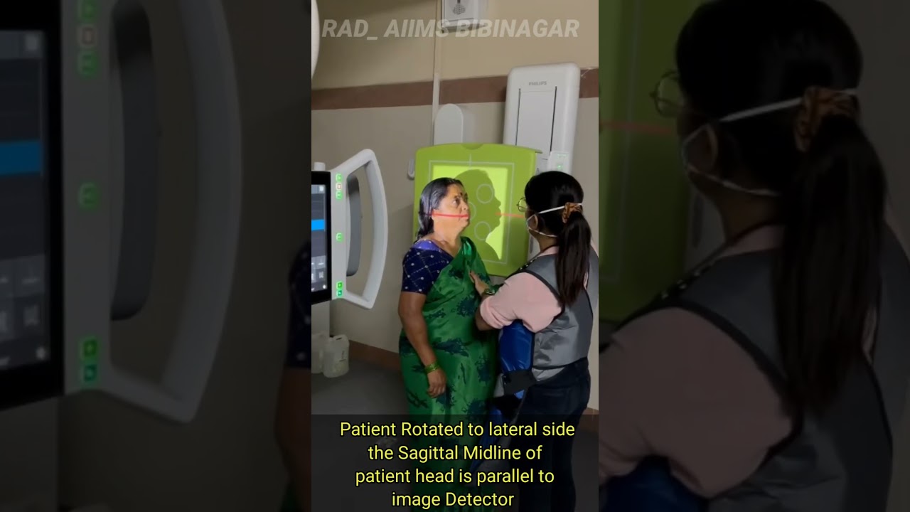 How to take Skull AP and Lateral View