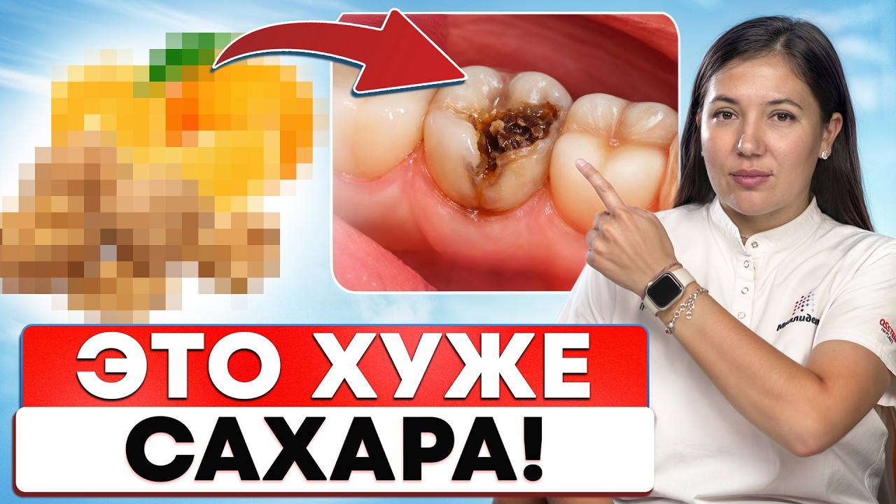 Как замедлить кариес и ЗАЩИТИТЬ ЭМАЛЬ в ДОМАШНИХ УСЛОВИЯХ?