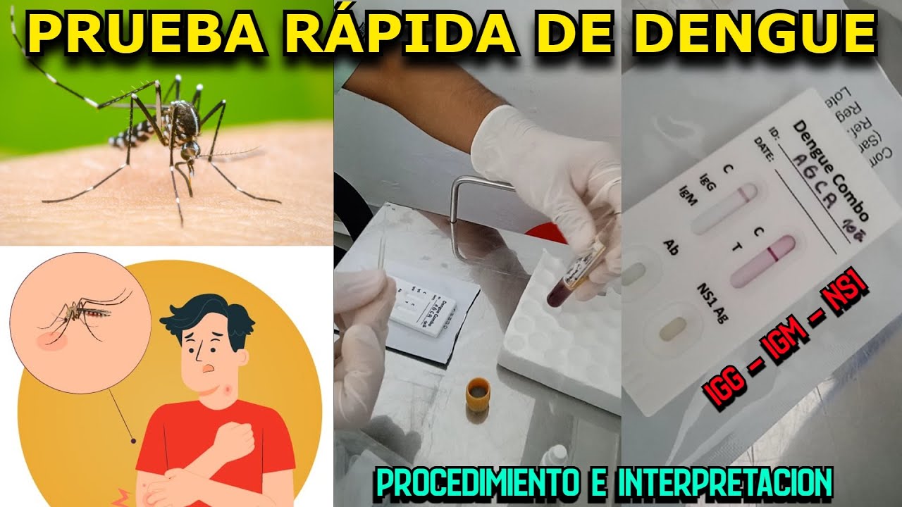Así Detectamos el Dengue en el Laboratorio (Procedimiento y Análisis)