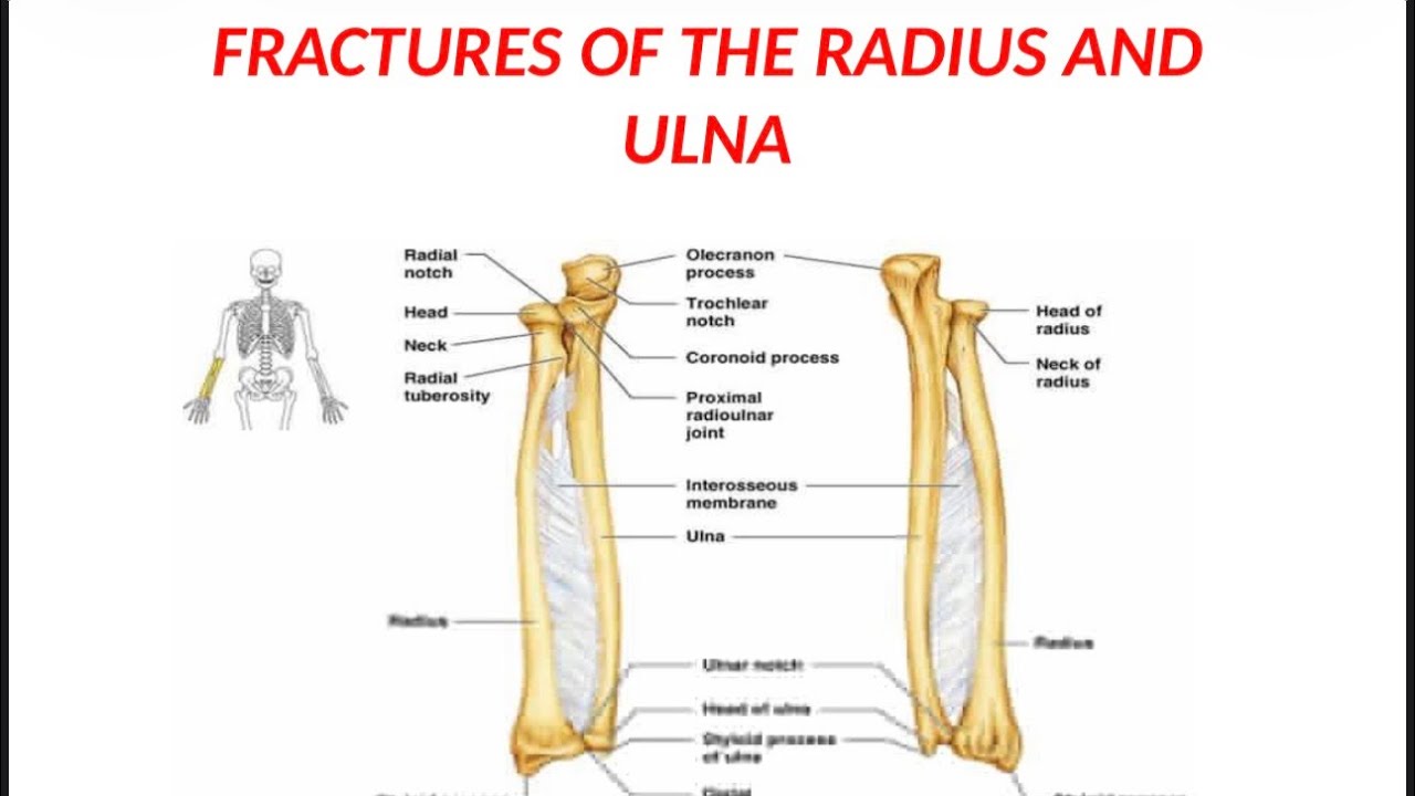 Orthopaedic : Fractures of the radius and ulna