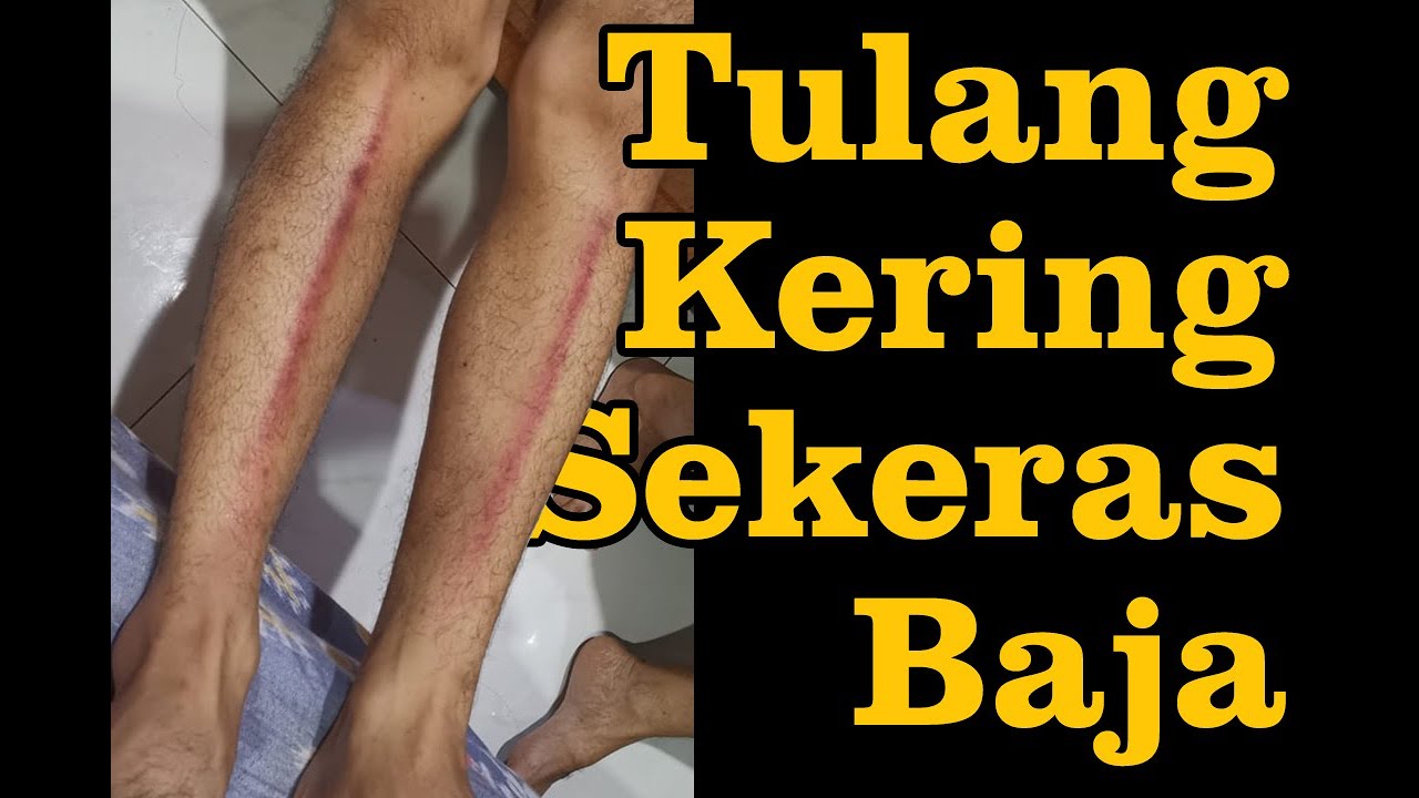 Cara Latihan Tulang Kering
