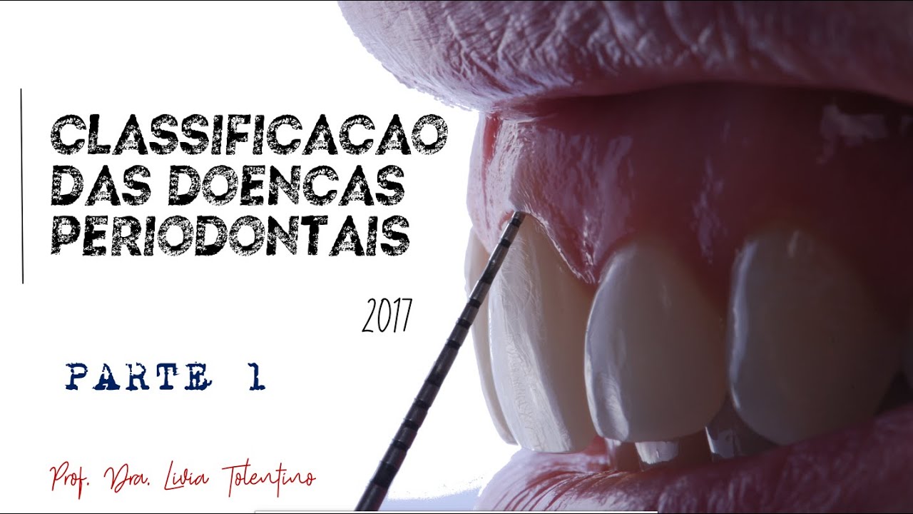 Aula Classificação das Doenças Periodontais (2017) - PARTE 1