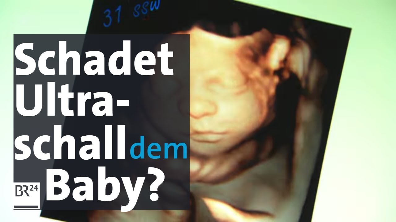 Babywatching: Wie gefährlich ist 3D-Ultraschall-Untersuchung in der Schwangerschaft für das Baby?