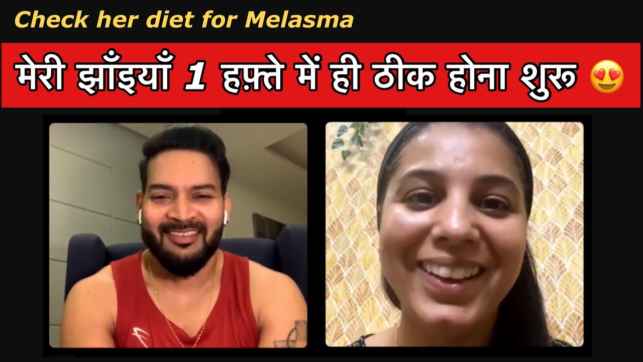 मेरी झाँइयाँ 1 हफ़्ते में ही ठीक होना शुरू 😍 Check her diet for Melasma