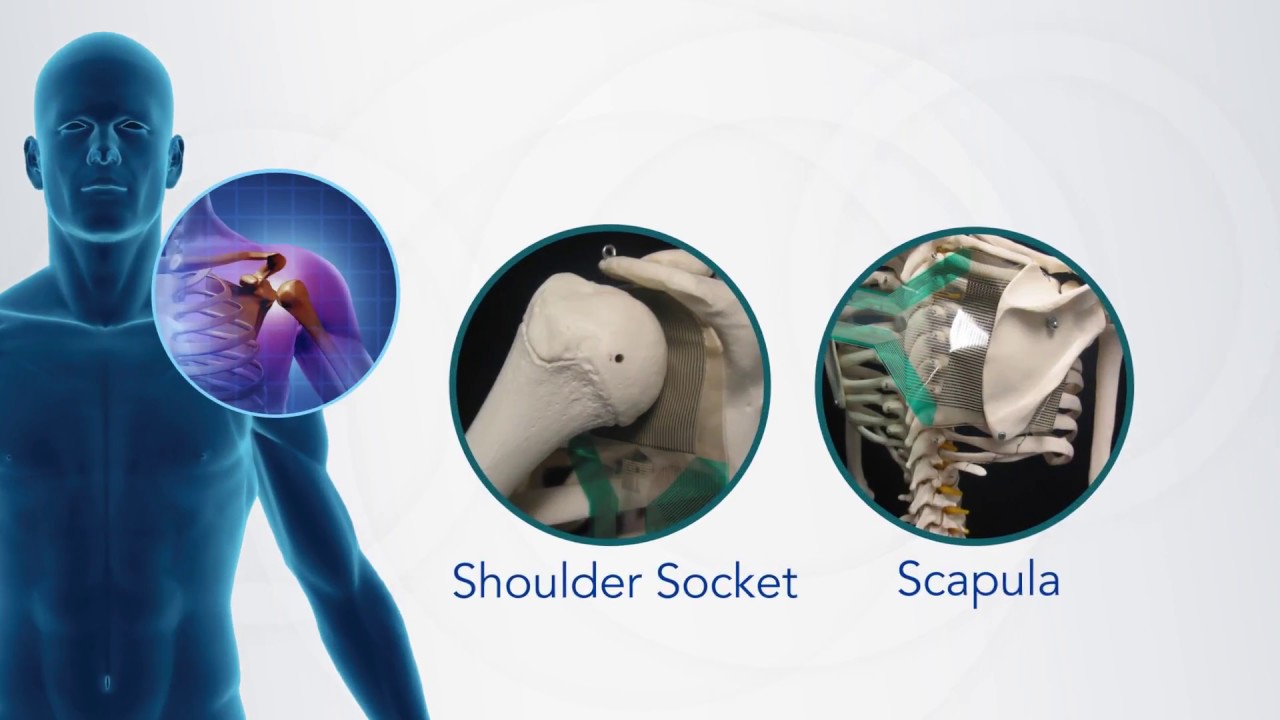 Tekscan Sensors for Orthopedic Joint Analysis