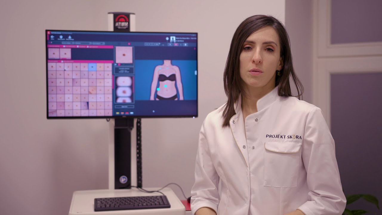 Wideodermatoskopia
