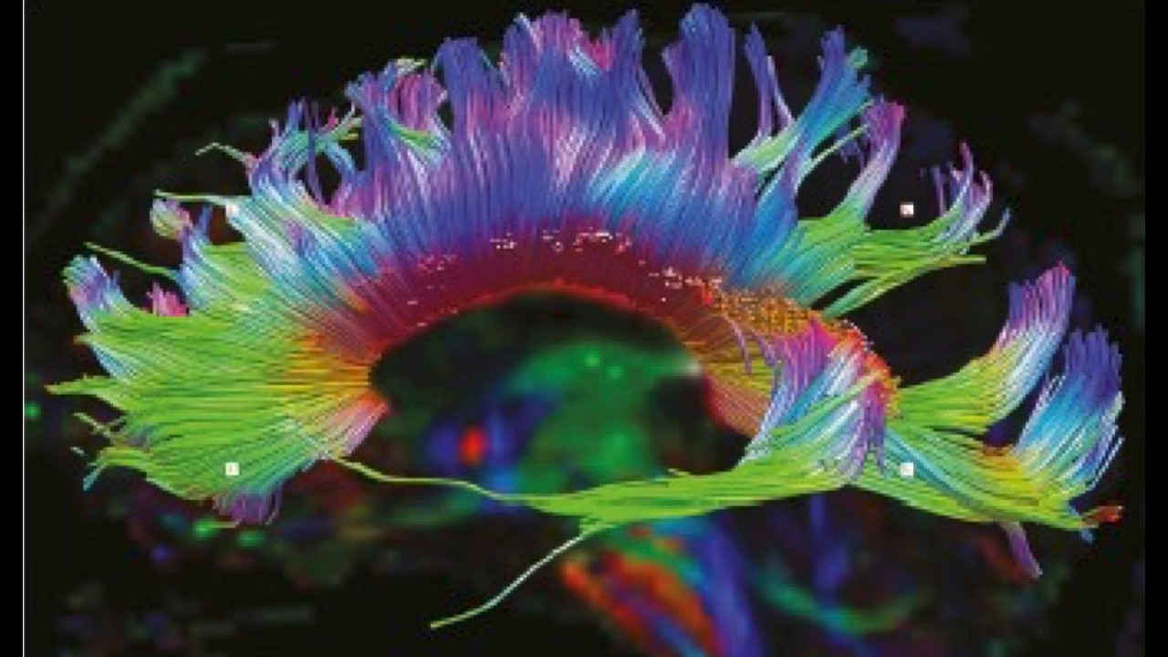 Struttura e anatomia del Sistema Nervoso Centrale [2]