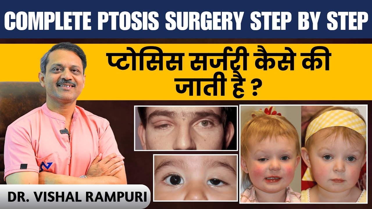 पलकों के झुकने की समस्या को ठीक करने के लिए Ptosis Surgery कैसे की जाती है ? Ptosis Surgery Steps
