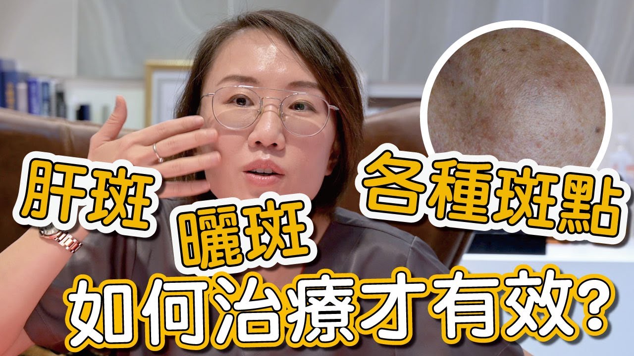 肝斑、色素不均是如何造成？來看看莊盈彥醫師治療肝斑的方式有哪些！