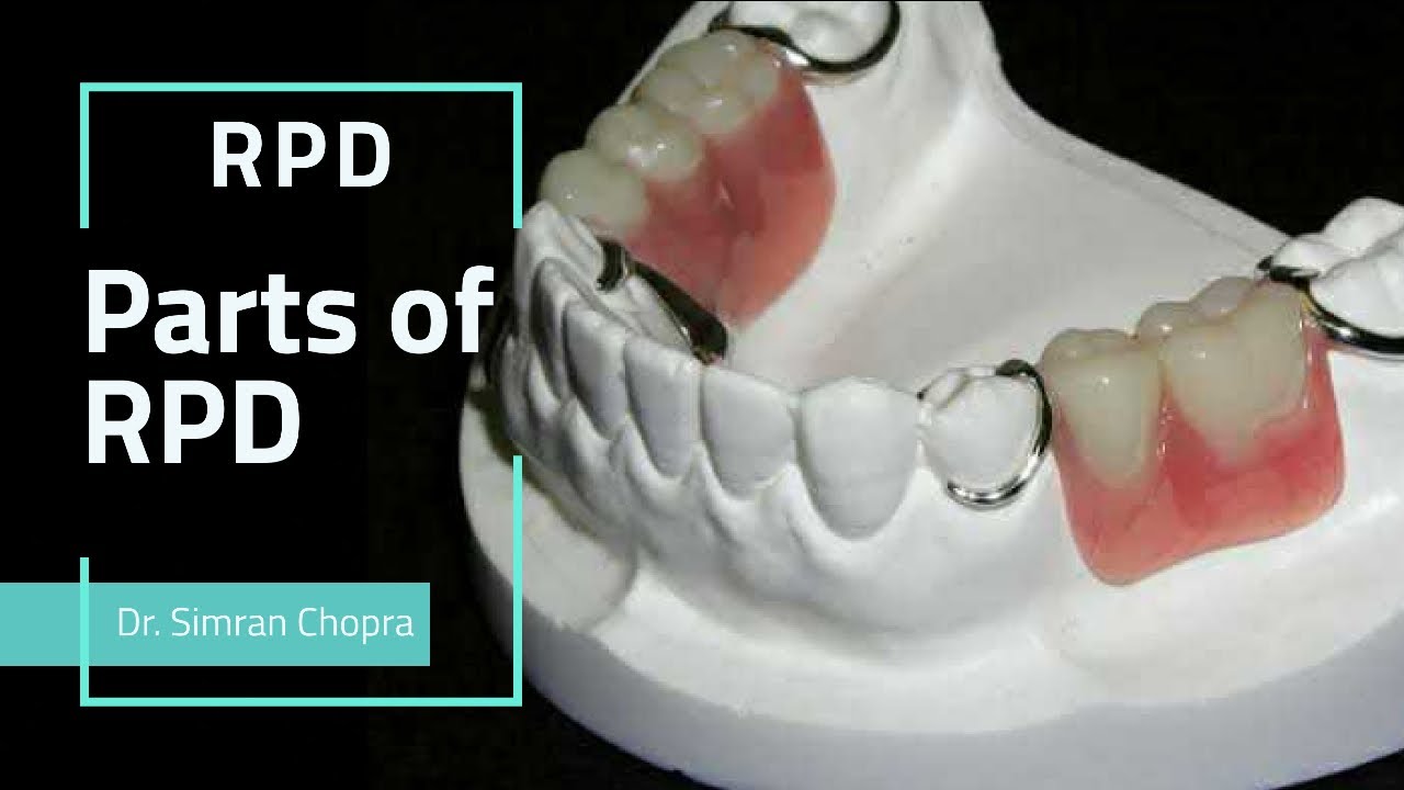 Removable Partial Denture l Parts Of RPD l Prosthodontics
