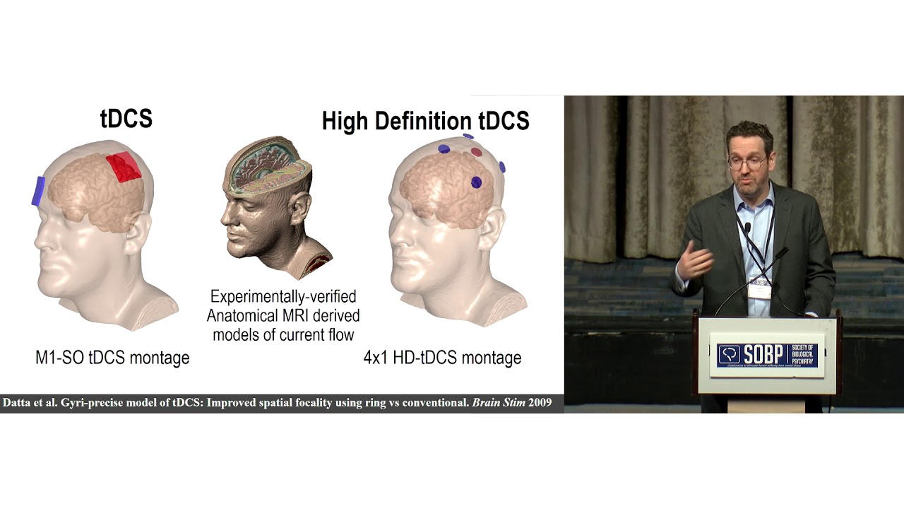 Dr. Marom Bikson: The potential and Limitations of Transcranial Direct Current Stimulation