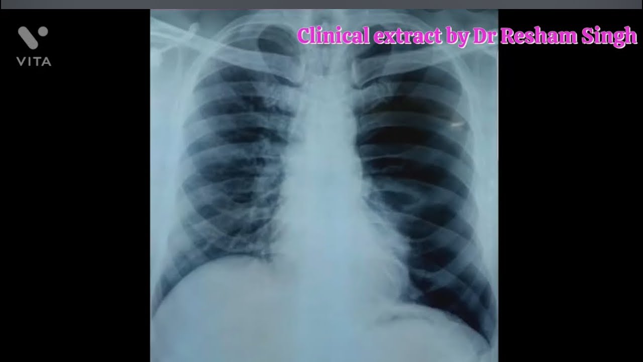 DNB medicine final year practical examination OSCE part-1