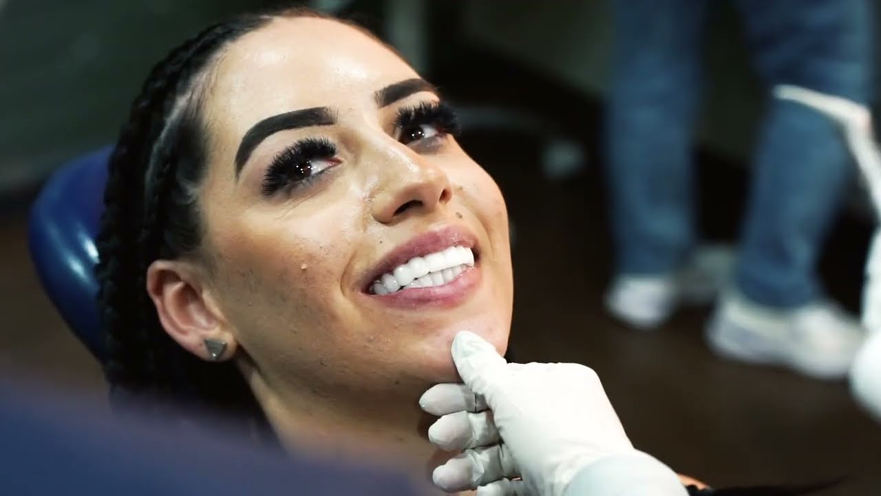 Transforme o Seu Sorriso com Facetas Dentárias! | Melhor Clínica Dentária em Antália, Turquia 🌟