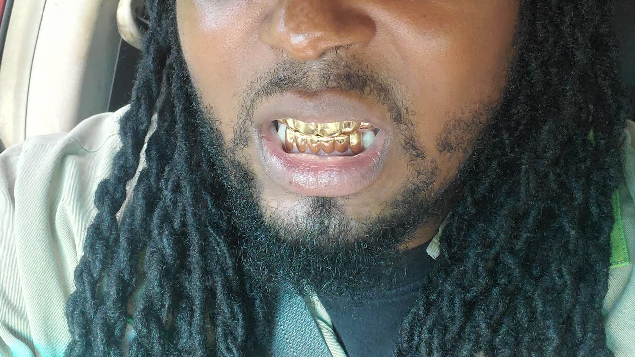 Custom Gold Grillz [Custom-Fit] 10k Solid Gold Deep Cut Grillz Review And Gold Tested