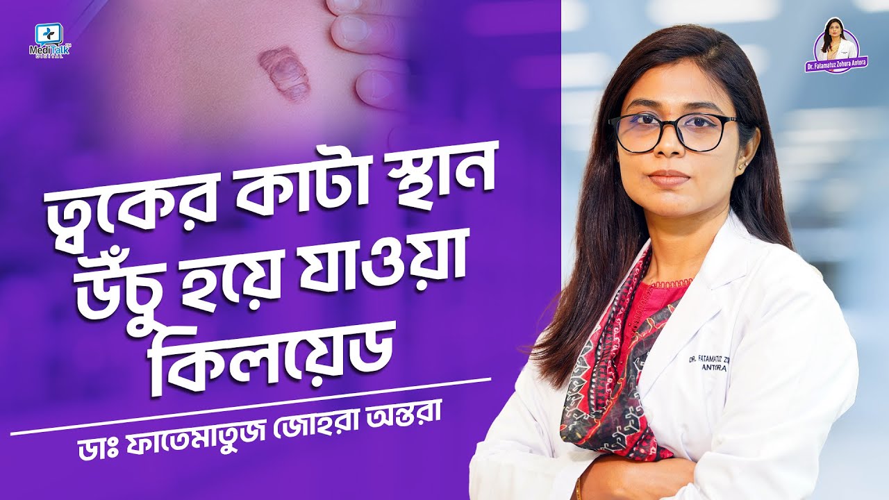 ত্বকের কাটা স্থান উঁচু হয়ে যাওয়ার সমস্যা #skinproblems