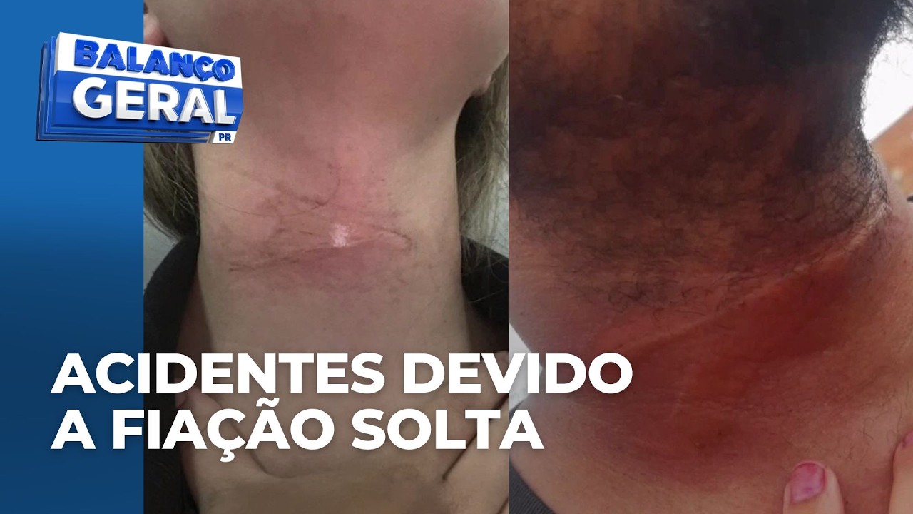 Fiação solta tem causado diversos problemas e um deles é acidente na região de Maringá