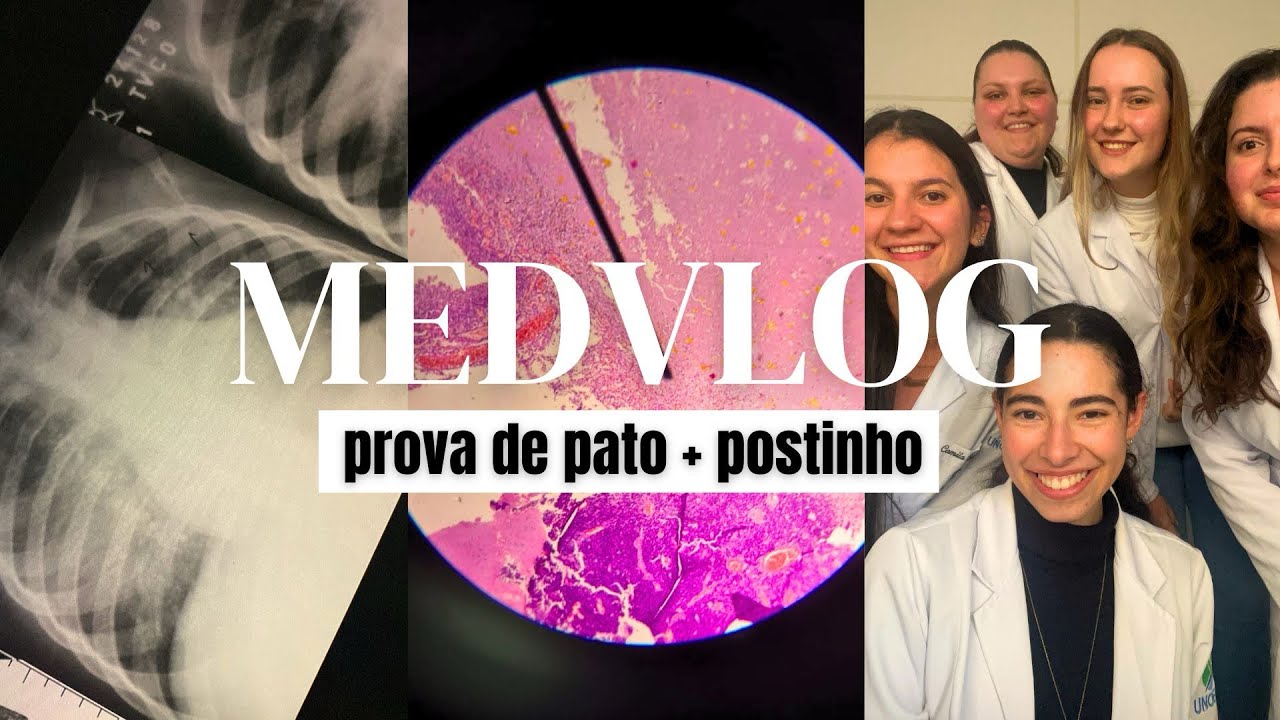 MEDVLOG #25 - prova de patologia na segunda semana de aula, prática de propedêutica na ubs e +