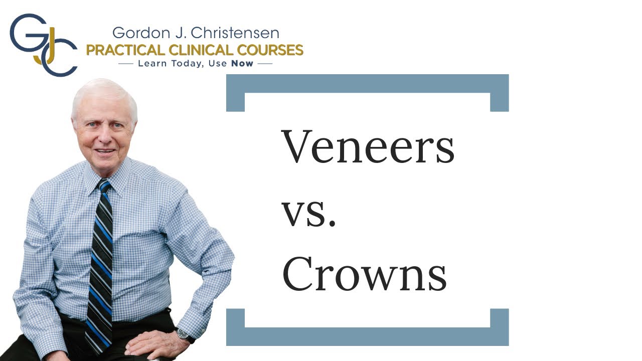 Veneers vs crowns?