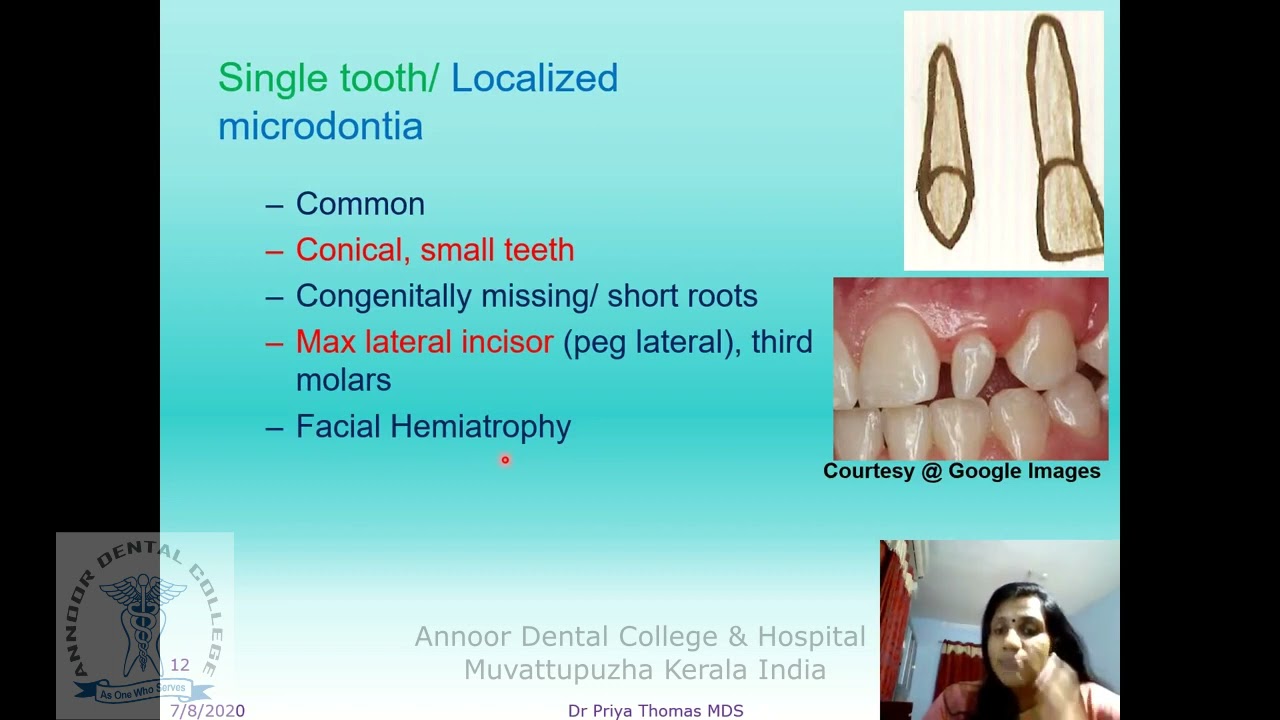 Development and Disturbances of Oral and Paraoral Structures