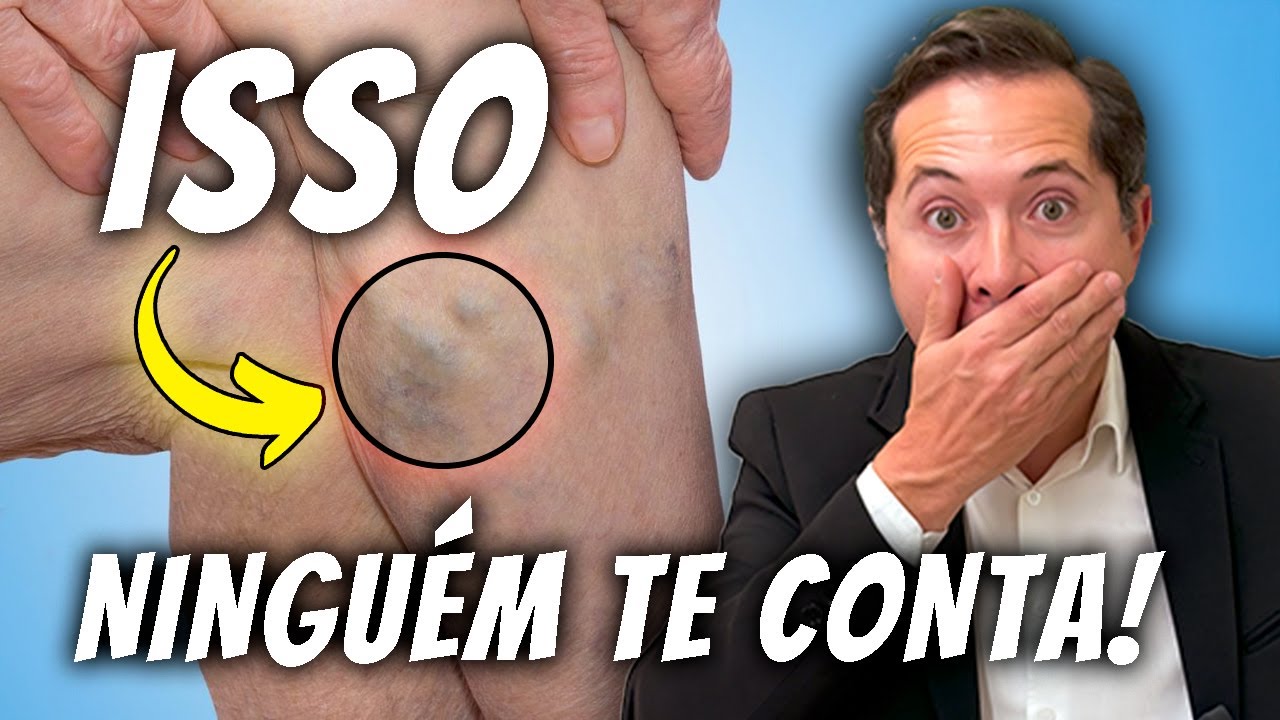 Trombose tem cura?
