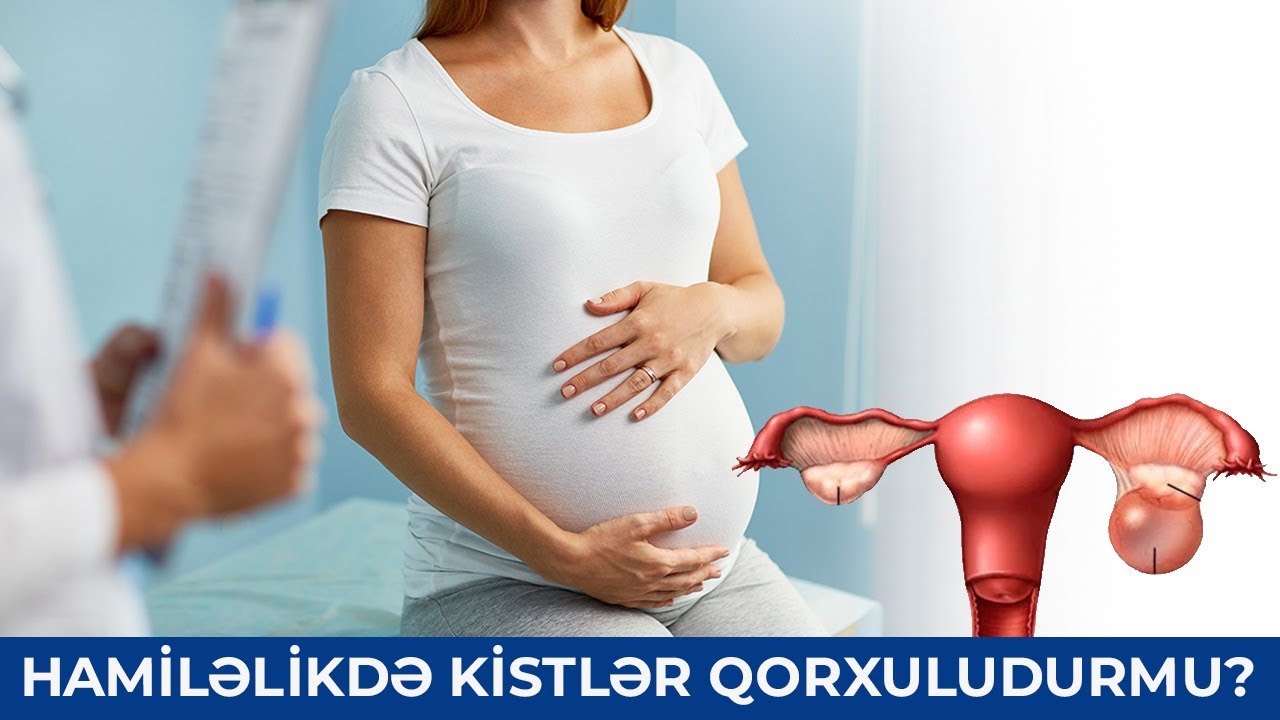 Hamiləlikdə Kista - Aytən İbrahimova (Mama-ginekoloq)