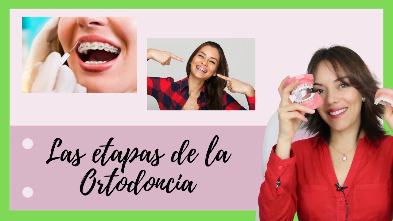 ETAPAS DE LA ORTODONCIA | FASES DEL TRATAMIENTO