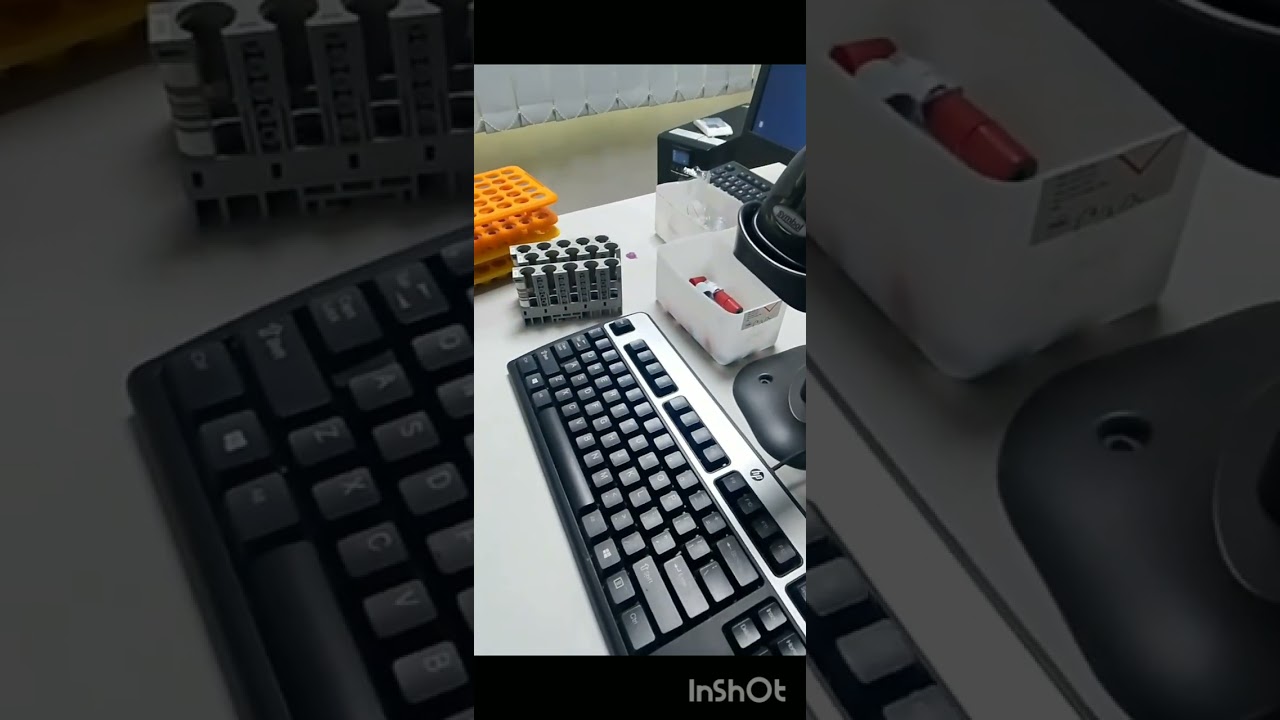 Roche cobas&reg; 6000 Machine  Backup Data sample  count.#machine #vlogwithsohelvillagelifestylei