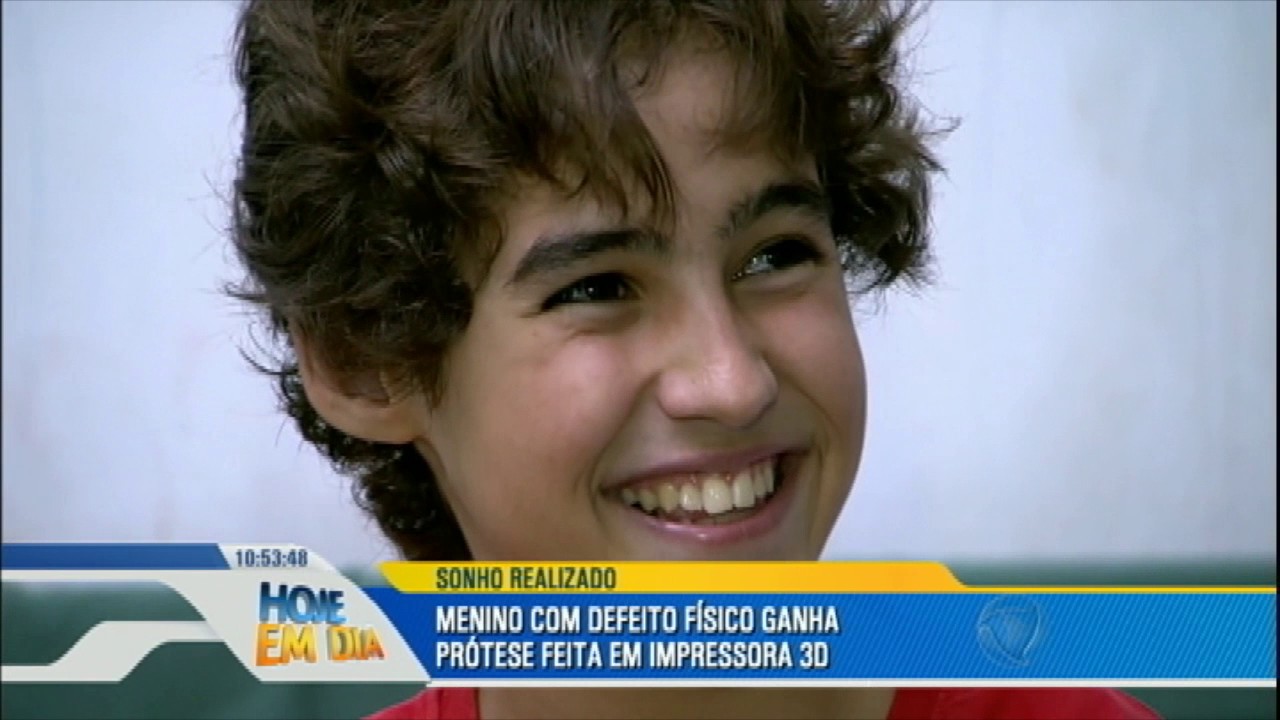 Engenheiro cria prótese inspirada no Homem de Ferro para realizar sonho do menino