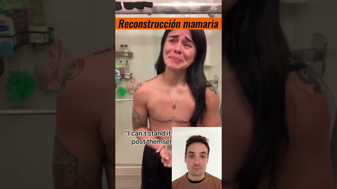 🎗️ &iquest;Qu&eacute; es una mastectom&iacute;a bilateral con reconstrucci&oacute;n mamaria?