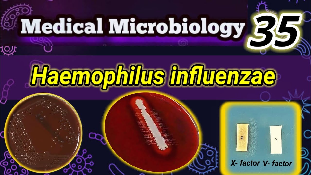 Haemophilus influenzae شرح بالعربي