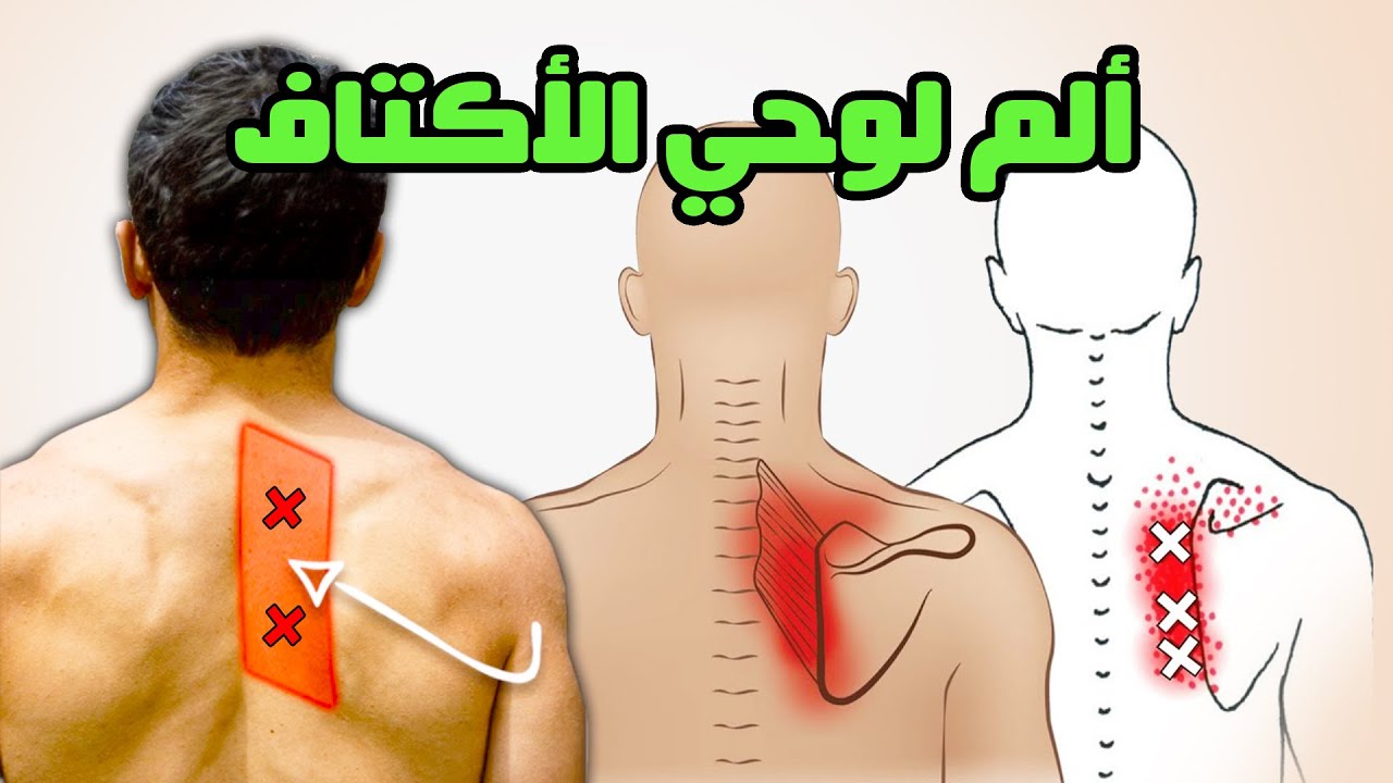 تخلص من #ألم_الطعن #اﻷبهر #الوثاب #الخلج بين لوحي الكتف والعمود الفقري في غضون 10 دقائق فقط
