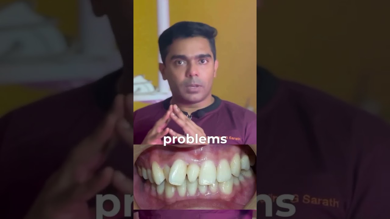What Are Supernumerary Teeth? Important Information for Patients