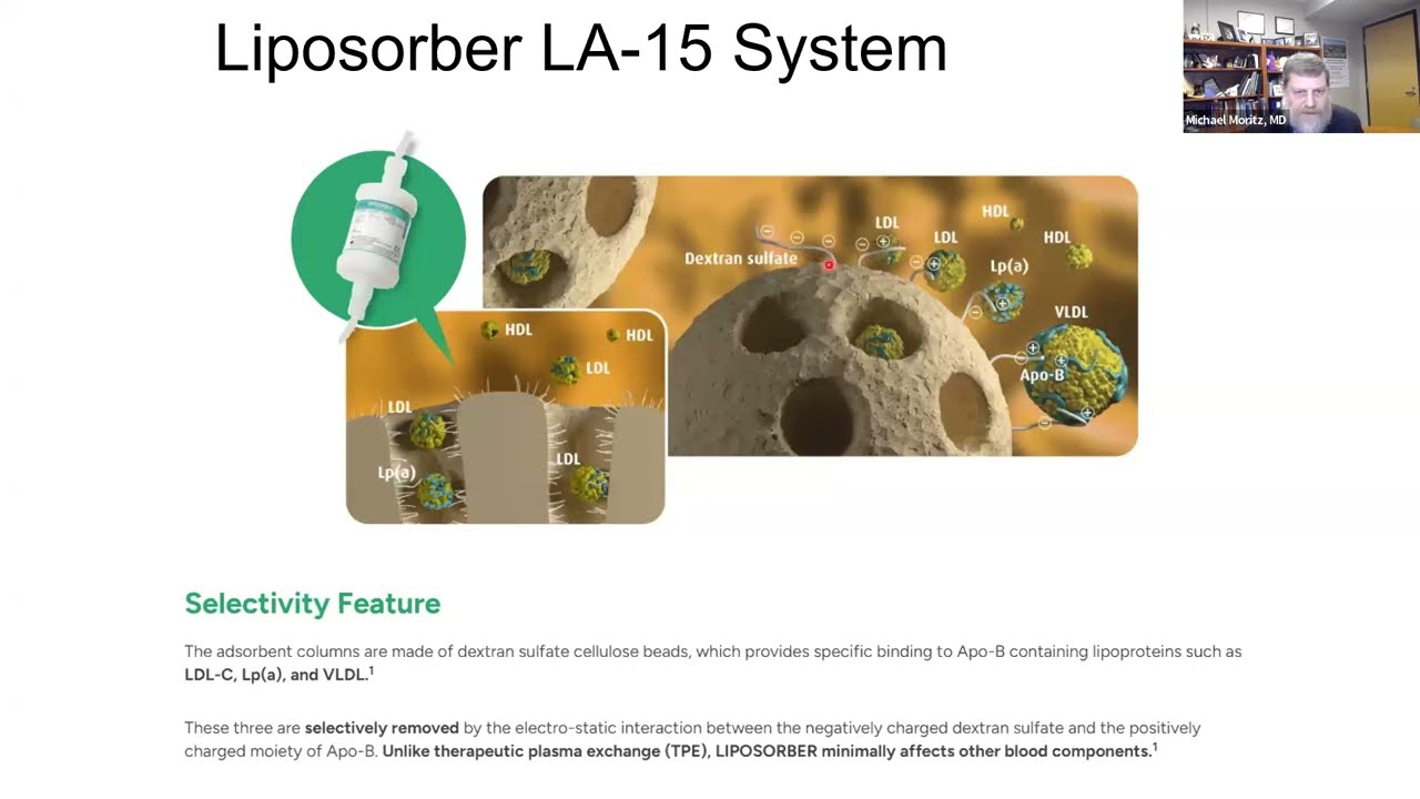 Pediatric & Adult FSGS: When All Else Fails, Lipoprotein Apheresis? - CME Recording