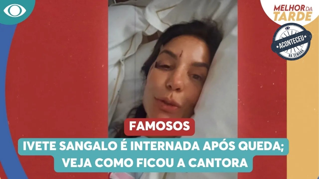 Ivete Sangalo é internada após queda; veja como ficou a cantora | Aconteceu Na Semana