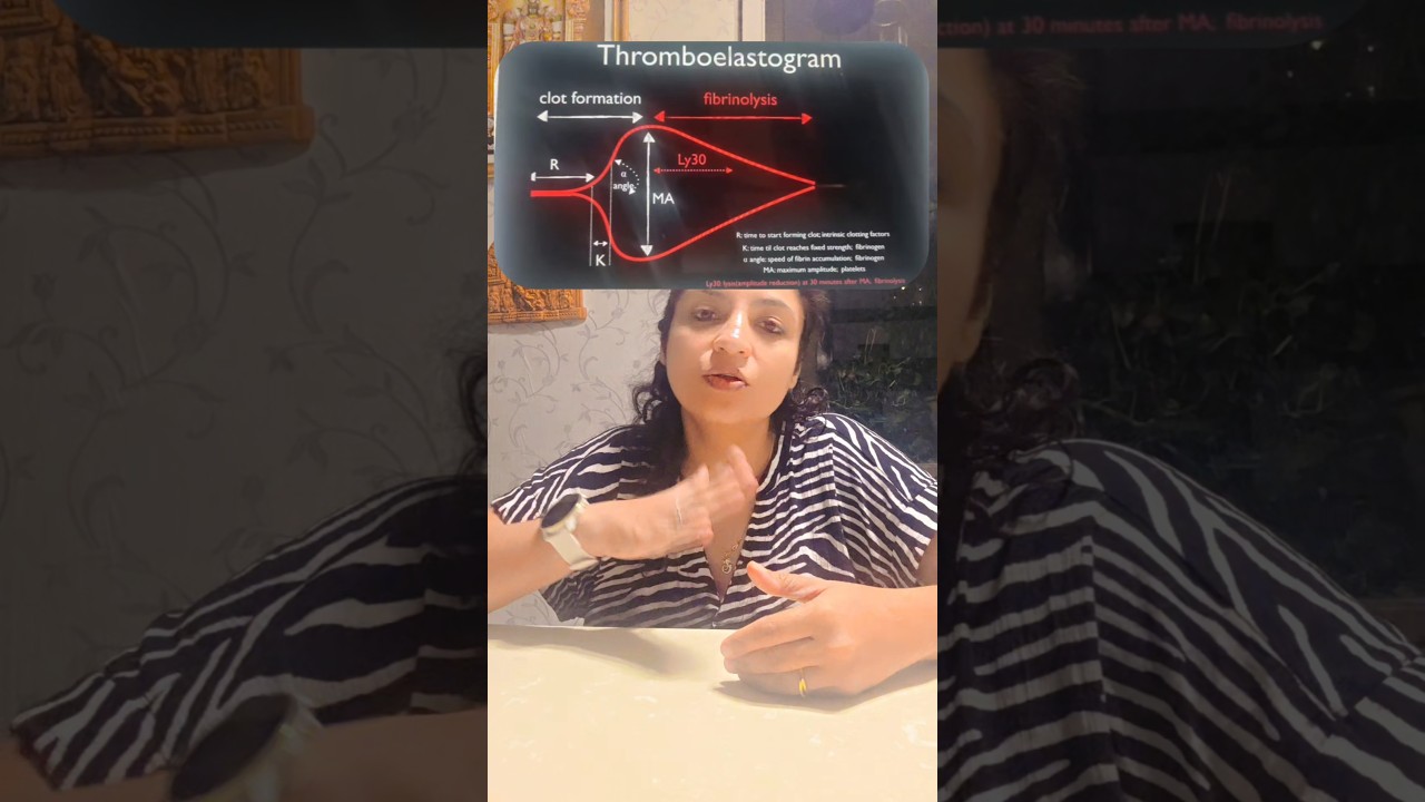 🩸 Тромбоэластография (ТЭГ) &mdash; где наука встречается с искусством свертывания крови!
