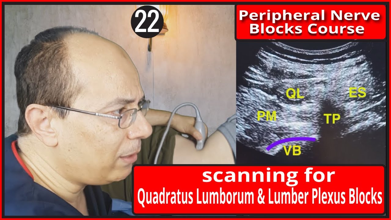 scanning for Quadratus Lumborum & Lumber Plexus Blocks ) |Mohamed Hamada|(22)