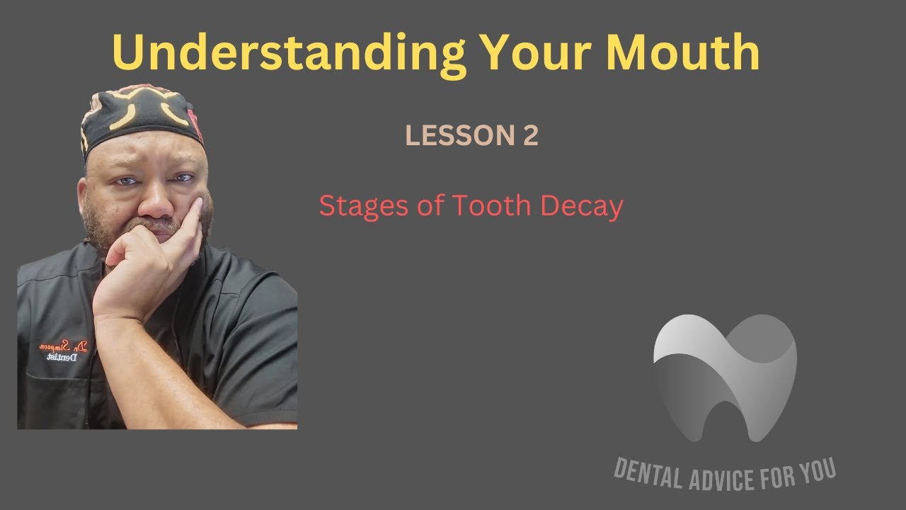 Understanding Your Mouth - Lesson 2 - Stages of Tooth Decay