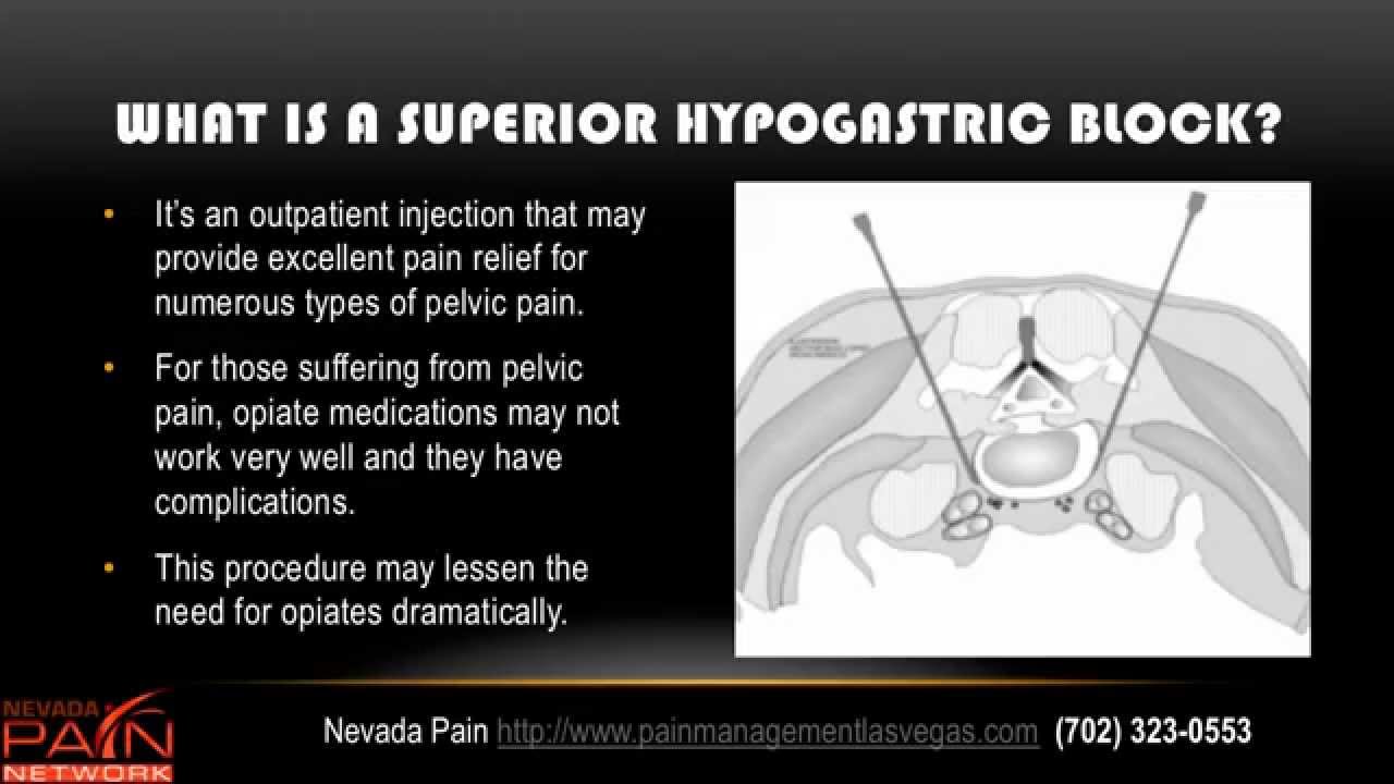 Superior Hypogastric Plexus Block Explained by a Las Vegas Pain Center (702) 323-0553