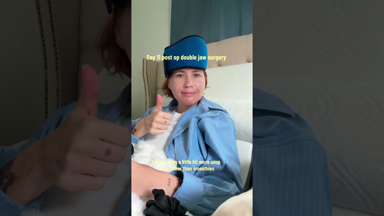 Day 11 post op double jaw surgery 