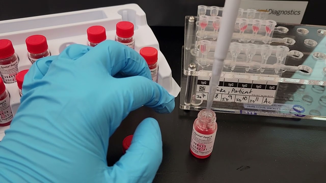 Blood Banking: How to Perform a Gel Antibody Identification Panel