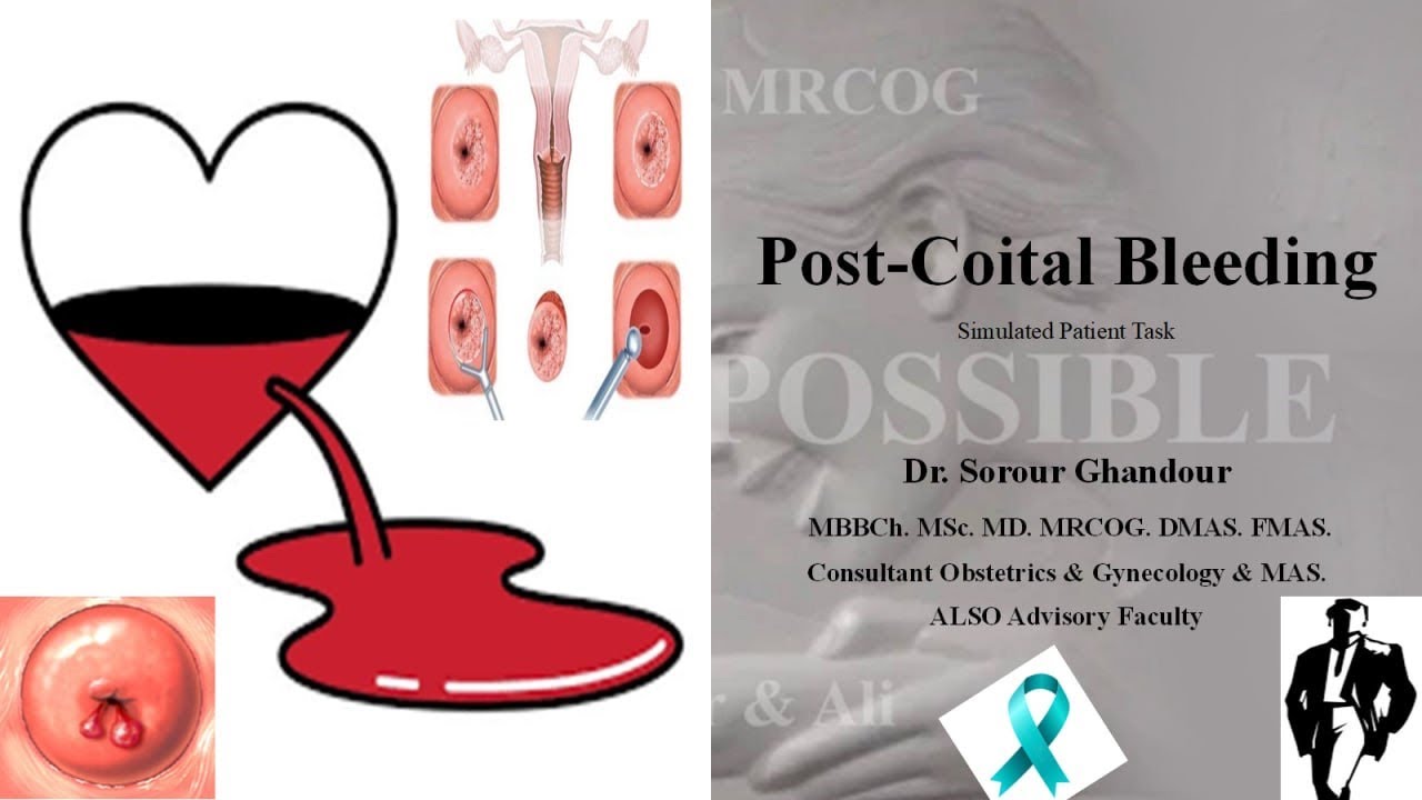 Post-Coital Bleeding - MRCOG Part 2 & 3 Tasks