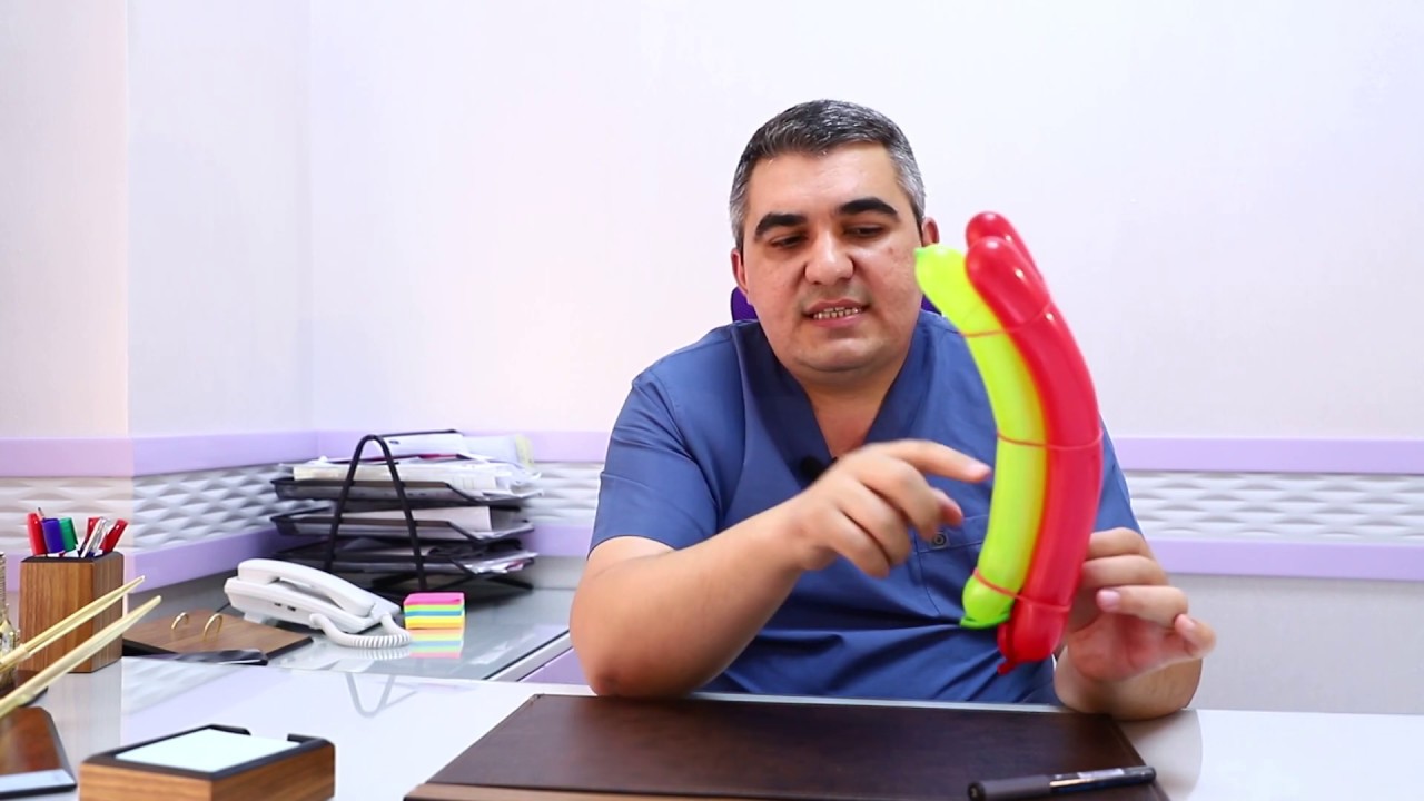 Peyroni xesteliyi haqqinda androloq-cerrah Dr.Tariyel Mammadov Tel/WhatsApp +994557181666