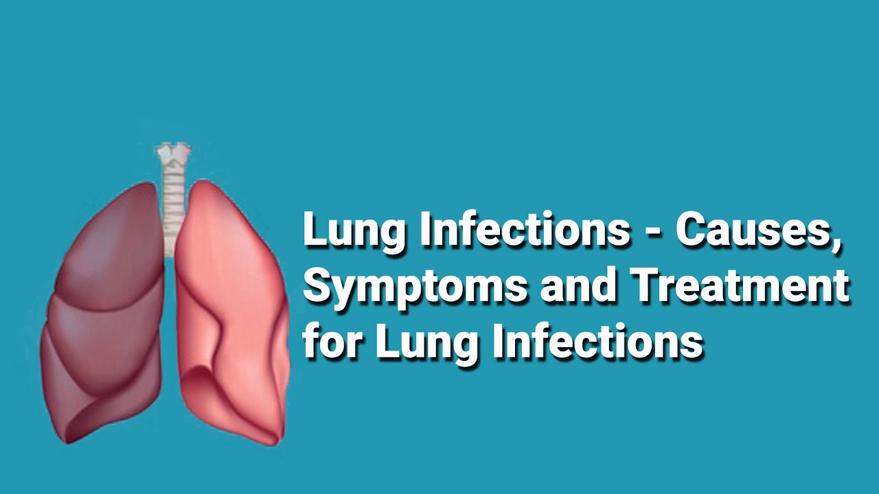 Lung Infections: Classification, Symptoms & Treatment &ndash; Respiratory Medicine | Dept. of Pulmonology