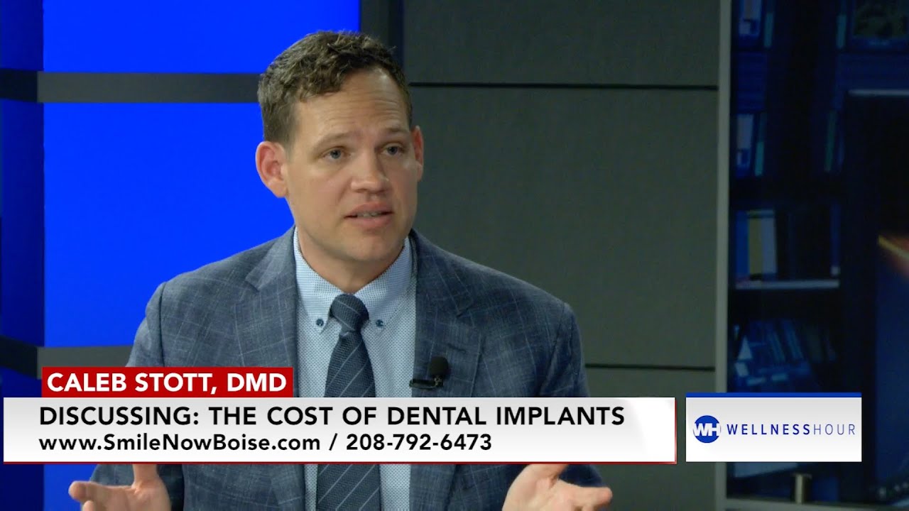 Dental Implant Cost Guide