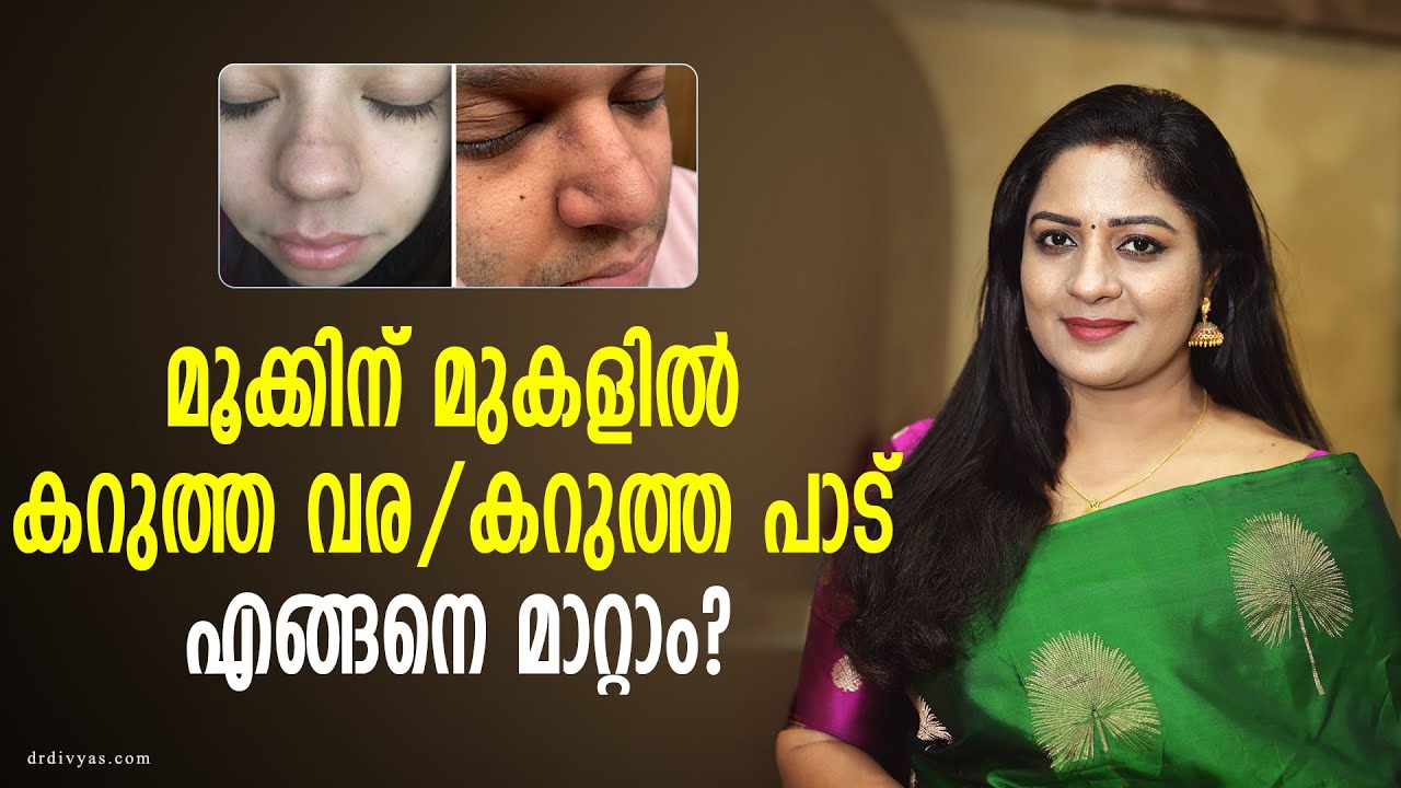 മൂക്കിന് ചുറ്റുമുള്ള കറുത്തവര/കറുത്തപാട് എങ്ങനെ മാറ്റാം Black Line On The Nose & Pigmentation Remedy