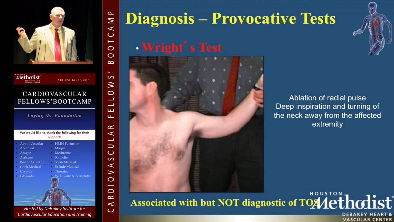 Diagnosis and Imaging of TOS and Upper Extremity Disease (Mark Mattos, MD)